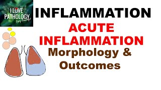 INFLAMMATION Part7 MORPHOLOGY amp OUTCOMES of Acute Inflammation [upl. by Aronal718]