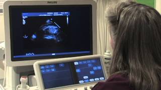 Understanding Echocardiogram ECHO and Its Importance for Heart Health [upl. by Inram309]