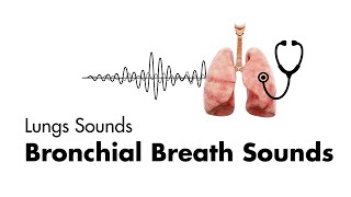 Bronchial Breath Sounds  EMTprepcom [upl. by Ahseikan]