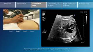 Prenatal CellFree DNA Screening cfDNA Screening [upl. by Dry]