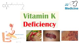 Is it Safe to Take 10000 IUs of Vitamin D3 [upl. by Sande360]