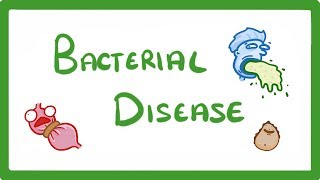 GCSE Biology  What Are Bacterial Diseases  Treatment and Prevention 37 [upl. by Hiro]