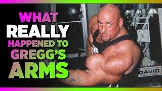 What Do Gregg’s Arms Look Like Now  Storytime With Gregg Valentino [upl. by Aerdnod600]