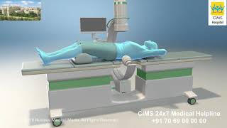 Extracorporeal Shock Wave Lithotripsy ESWL – CIMS Hospital [upl. by Suoivatnom]