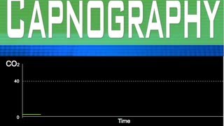 EtCO2 Capnography Part 1 [upl. by Seem450]