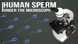 Human Sperm under the microscope [upl. by Tortosa]