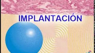 implantacion [upl. by Aineg]