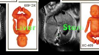 Learn OBGYN Fetal Heart Rate Monitoring  Nonstress Test [upl. by Eceeryt]