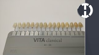 DentalQuickTip How to Arrange Your Vita Shade Guide in Value Order [upl. by Atselec]