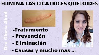 CICATRICES QUELOIDES ▶ Causas prevención y tratamientos ✅ [upl. by Cirda]