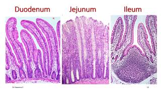 Duodenum 1st Part  Anatomy  Part 2 [upl. by Chevy]