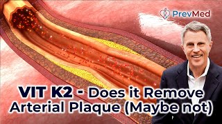 Vit K2  Does it Remove Arterial Plaque [upl. by Crandall]