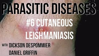 Parasitic Diseases Lectures 6 Cutaneous Leishmaniasis [upl. by Airetas921]