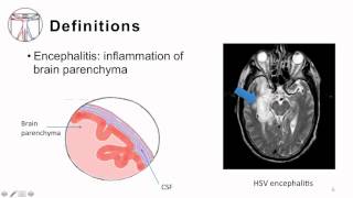 2 Bacterial Meningitis Pathogenesis and Clinical Manifestion [upl. by Levitan]