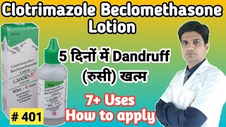 Candid B lotion  Candid B lotion for hair dandruff  Clotrimazole beclomethasone lotion [upl. by Pressman911]