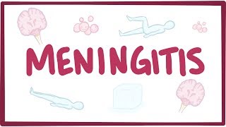 Meningitis  causes symptoms diagnosis treatment pathology [upl. by Ahsilet]