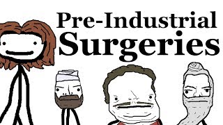 PreIndustrial Surgeries [upl. by Hazard]