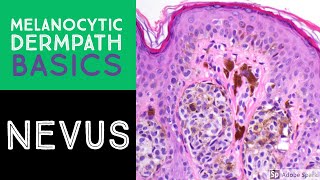 Melanocytic Dermpath Basics Benign Nevus [upl. by Palmer230]