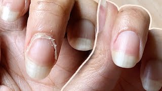 NAIL TRANSFORMATION  how I CUT CUTICLES at HOME  Basic Tools ONLY [upl. by Aras]