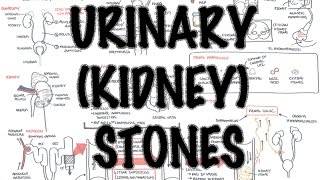 UrinaryKidney Stones  Overview signs and symptoms risk factors pathophysiology treatment [upl. by Myo]