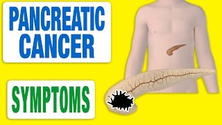 Pancreatic Cancer  All Symptoms [upl. by Atiuqehs]