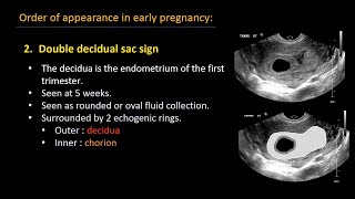 Fetal Echocardiography in Pregnancy  Dr Mahua Roy Hindi [upl. by Grosberg610]