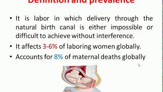 Obstructed Labor [upl. by Montana]