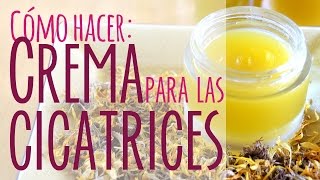 Crema casera para las cicatrices [upl. by Ayisan]