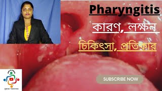 Pharyngitis In Bangla  Causes  Treatments  Home Remedies [upl. by Neeleuqcaj]