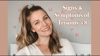 Signs and Symtoms of Trisomy 18 Edwards Syndrome  Trisomy 18 101 [upl. by Harmon808]