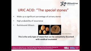 Urowebinar Medical Management of Urolithiasis [upl. by Arihat656]