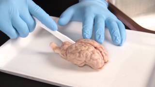 Carolina Quick Tip® Sheep Brain Dissection [upl. by Dimond]