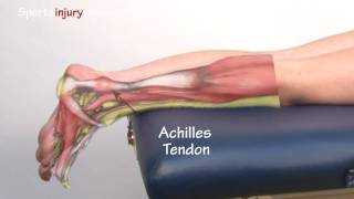 Achilles Tendonitis  Tendinopathy  Explained in 90 Seconds [upl. by Eniamraj235]