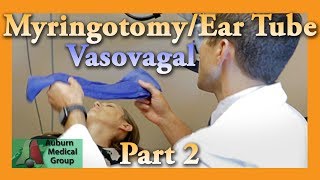 Myringotomy amp Ear Tube Part 2 Vasovagal Feat Dr Tim Fife  Auburn Medical Group [upl. by Alyekahs125]