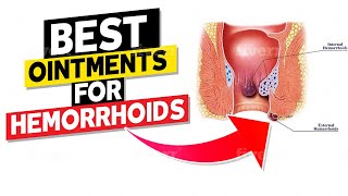 Best Ointments for Hemorrhoids [upl. by Janna]