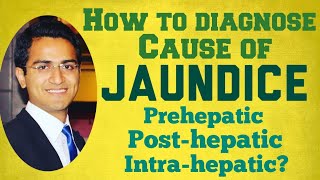 Jaundice Diagnostic Workup  Causes Symptoms amp Treatment [upl. by Nahej]