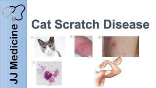 Cat Scratch Disease  Causes Symptoms and Treatment [upl. by Anya]