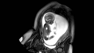 Foetal Development Unborn Baby Movement at 24 Weeks  WIRED [upl. by Frissell]