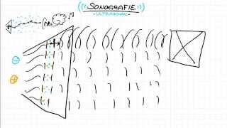 Ultraschall  Sonographie [upl. by Roche]