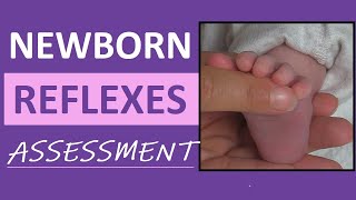 Newborn Reflexes Assessment Infant Nursing Pediatric NCLEX Review [upl. by Kannry]