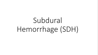 Subdural Hemorrhage SDH  General Surgery [upl. by Eikceb616]