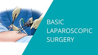 Basic Laparoscopic Surgery [upl. by Hopkins]