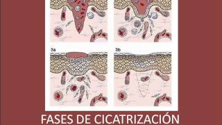 Fases de Cicatrización de las heridas [upl. by Hadlee878]