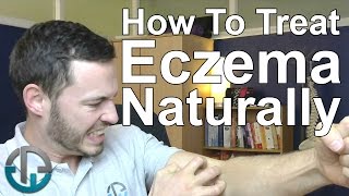 How To Treat Eczema Naturally [upl. by Kung]