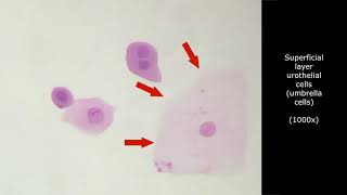 INTERPRETATION OF URINE CYTOLOGY Atlas and tutorial for cytotechnologist learning [upl. by Sue]