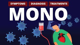 What is MONO Symptoms Diagnosis amp Treatments [upl. by Ecadnarb143]