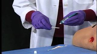 3M™ Tegaderm™ Hydrogel Wound Filler  Application and Removal [upl. by Ayoted893]