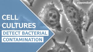 How to detect bacterial contamination in cell culture  moving particles are not always bacteria [upl. by Swaine]