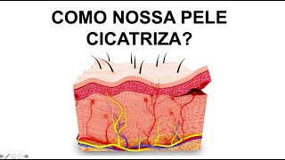 COMO OCORRE A CICATRIZAÇÃO NA PELE Por Luiz Gameiro dermatologista [upl. by Jordanson]